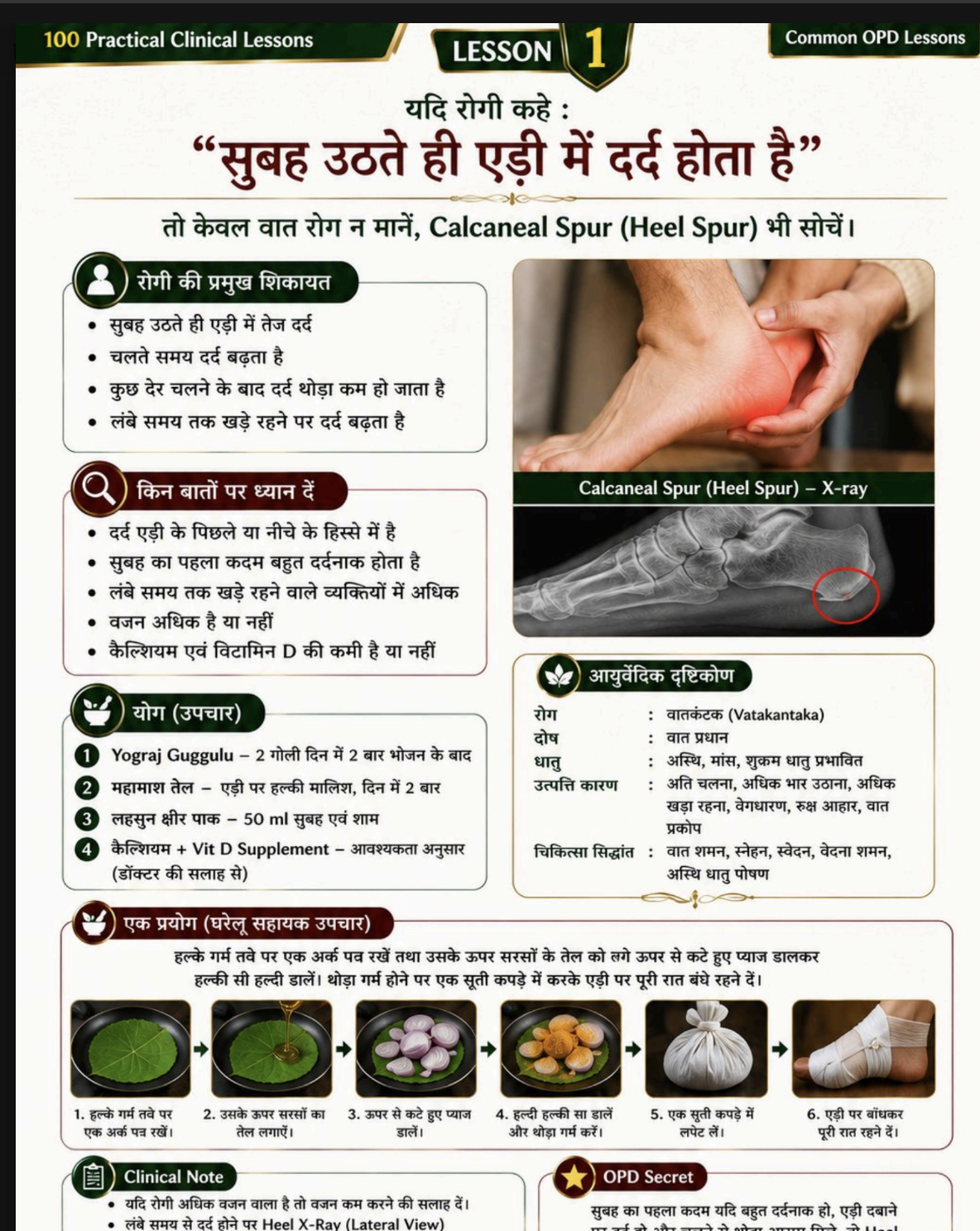 Hindi sample page: Amlapitta case with Nidan Panchak and Chikitsa Sutra in Hindi